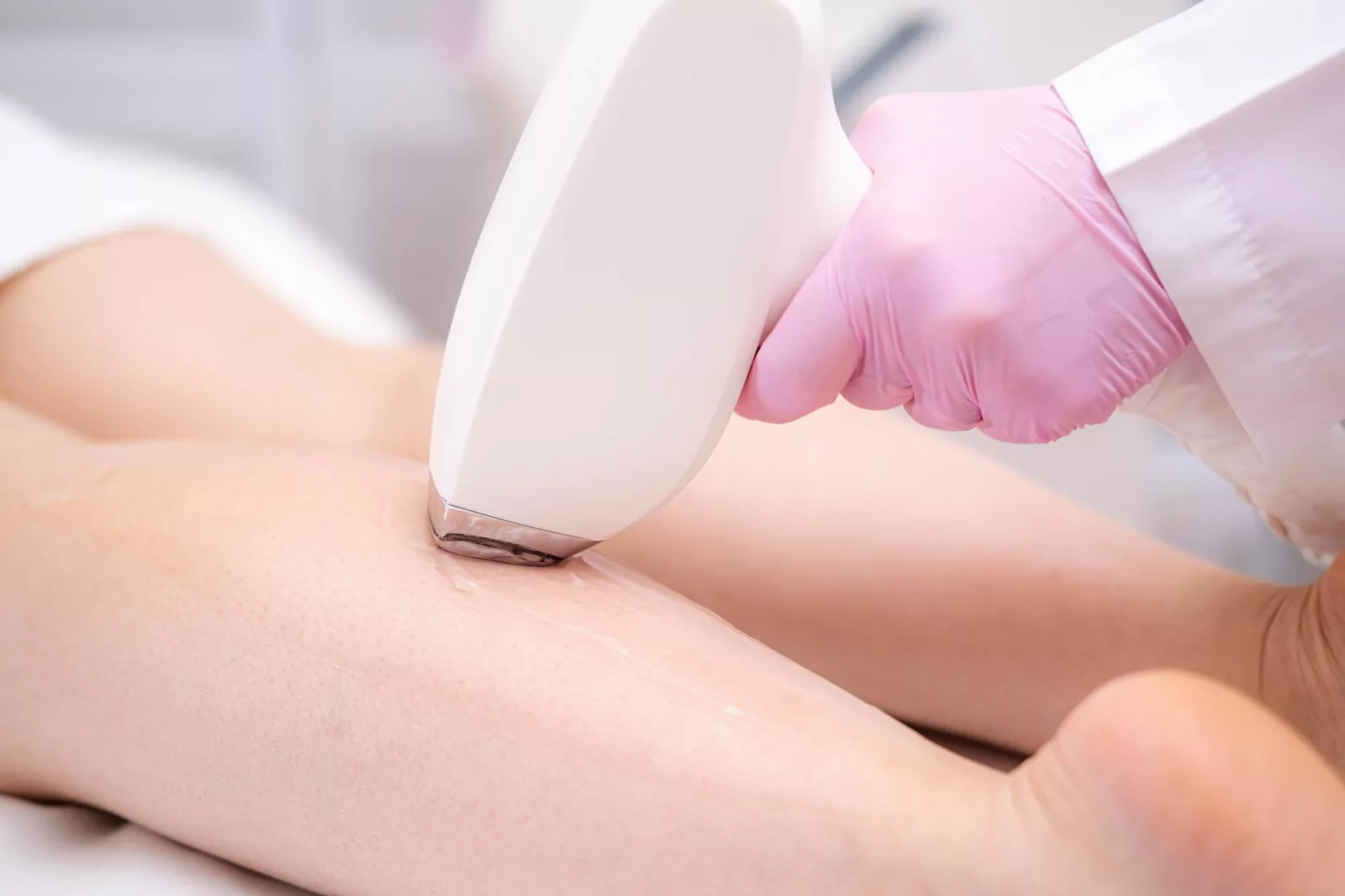 Épilation définitive au laser diode : comment se déroule votre première séance à Seilh